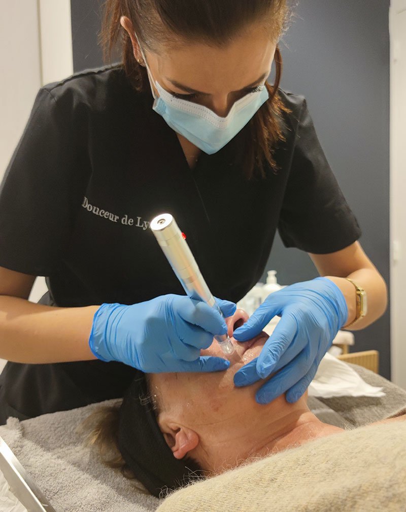 Micro-stimulation - soin Skinbooster - Institut de beauté Douceur de Lys à Rodez