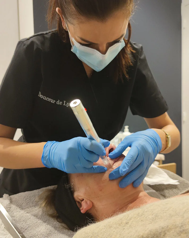 Micro-stimulation - soin Skinbooster - Institut de beauté Douceur de Lys à Rodez